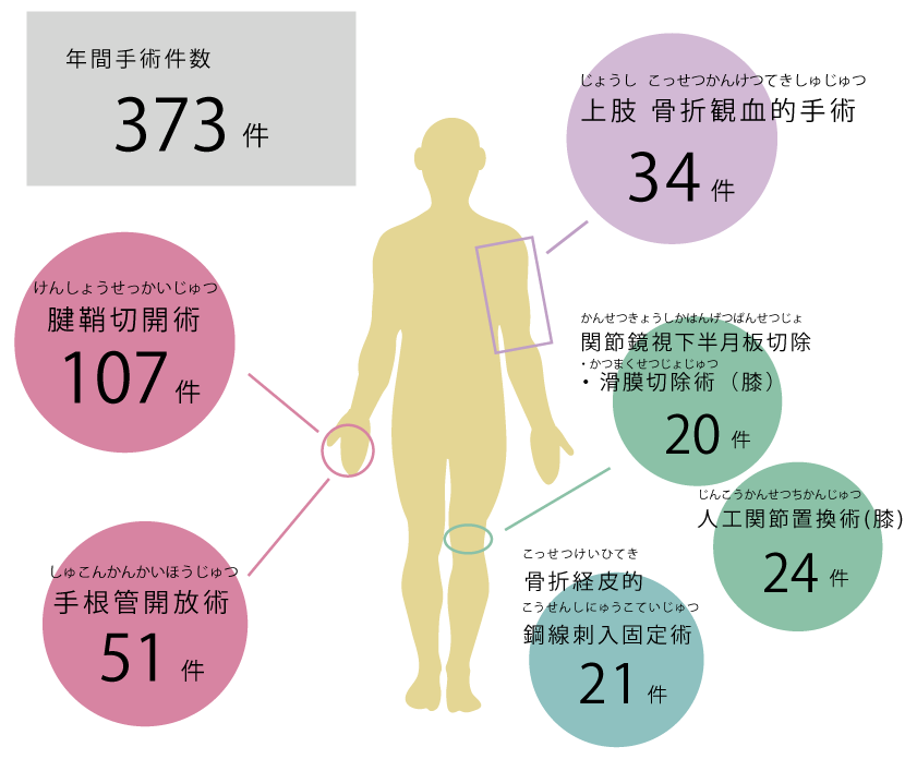 令和4年度 手術実績グラフ