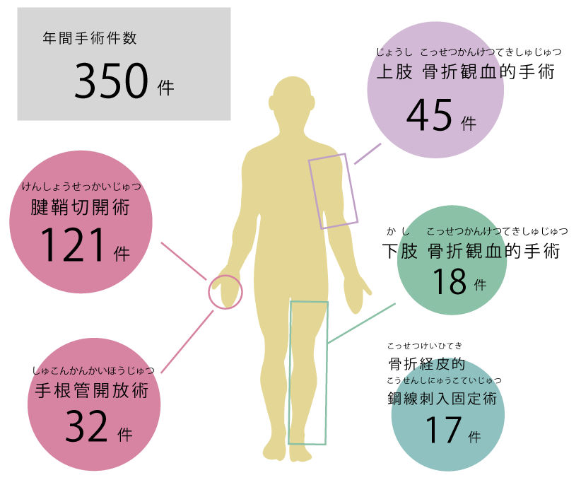 令和4年度 手術実績グラフ